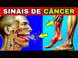 9 Sinais Comuns e Ignorados de CÂNCER