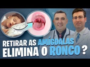 É normal continuar RONCANDO após RETIRAR as AMÍGDALAS? Pneumologista e Otorrino respondem