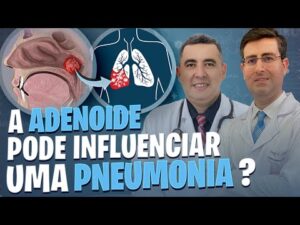 A ADENOIDE pode influenciar ou agravar uma PNEUMONIA? Médicos Otorrino e Pneumologista respondem