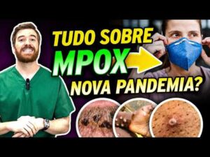 MPOX: O Que é? Nova PANDEMIA? Tem VACINA?