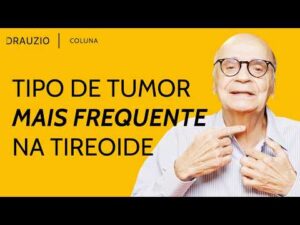 Como identificar e tratar o câncer de tireoide