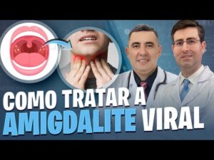 Como TRATAR a AMIGDALITE VIRAL? Otorrino e Pneumologista respondem