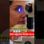 PRESSÃO ALTA no OLHO! #glaucoma #pressãoalta #visão #olhos