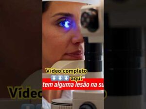 PRESSÃO ALTA no OLHO! #glaucoma #pressãoalta #visão #olhos