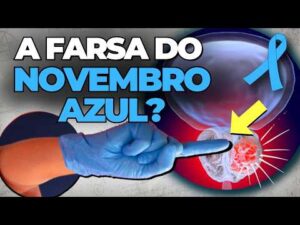 Por que Você NÃO PRECISA de EXAME DE TOQUE RETAL (PRÓSTATA)