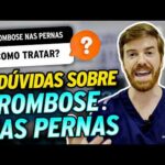 9 DÚVIDAS sobre TROMBOSE nas PERNAS! (Qual a cura? Como evitar? Caroços nas veias?)