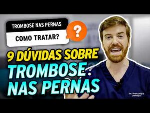 9 DÚVIDAS sobre TROMBOSE nas PERNAS! (Qual a cura? Como evitar? Caroços nas veias?)