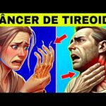 8 Sinais Estranhos de CÂNCER de TIREOIDE (Sintomas de Câncer na Tireoide)