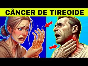 8 Sinais Estranhos de CÂNCER de TIREOIDE (Sintomas de Câncer na Tireoide)