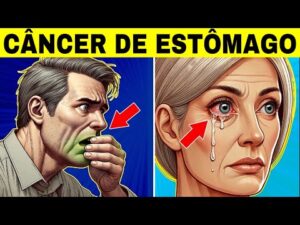 8 Sinais Estranhos de CÂNCER DE ESTÔMAGO (Sintomas de Câncer Gástrico)