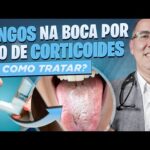 Qual o TRATAMENTO para FUNGOS na boca (Candidíase ORAL) por causa do uso de CORTICOIDE ORAL