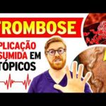 Perna Inchada Pode Ser Trombose? Descubra os Sinais de Alerta!