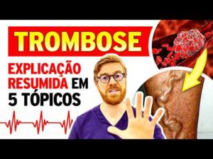 Perna Inchada Pode Ser Trombose? Descubra os Sinais de Alerta!