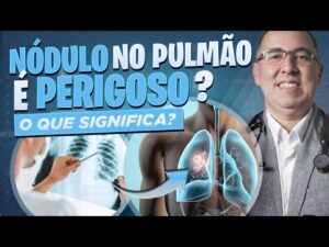 NÓDULO NO PULMÃO é preocupante e pode ser CÂNCER? Médico Pneumologista responde