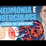 É TUBERCULOSE ou PNEUMONIA? Médico PNEUMOLOGISTA explica as diferenças e quais CUIDADOS tomar