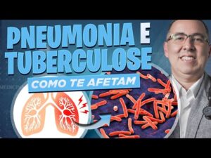 É TUBERCULOSE ou PNEUMONIA? Médico PNEUMOLOGISTA explica as diferenças e quais CUIDADOS tomar